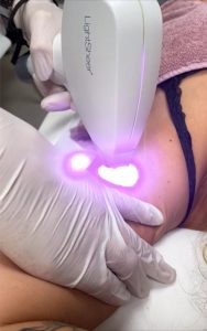 Wat kun je verwachten bij Lasertherapie?